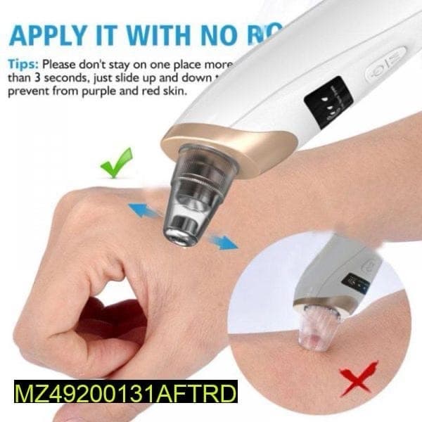 Pimple Blackhead Remover
