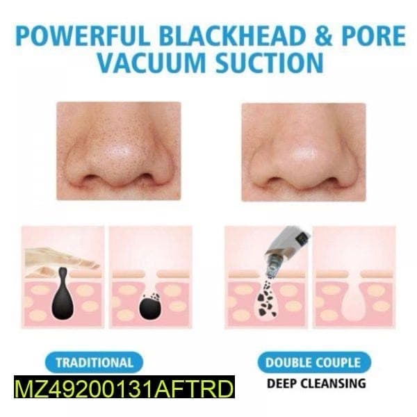 Pimple Blackhead Remover